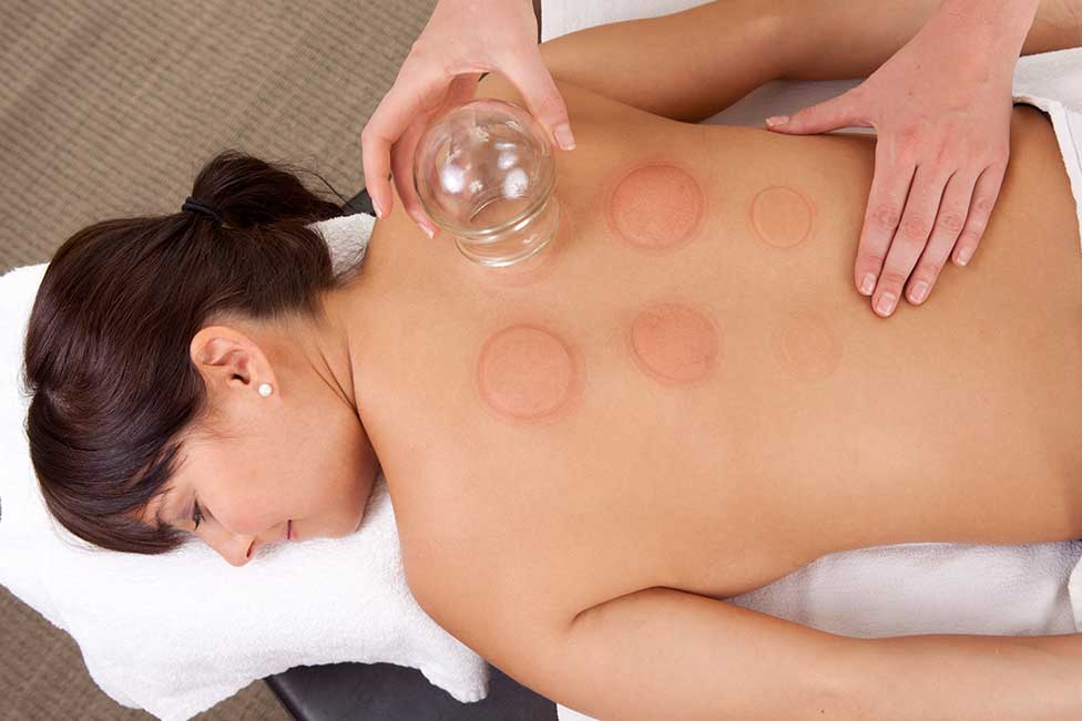 Winnipeg Cupping Massage Therapy